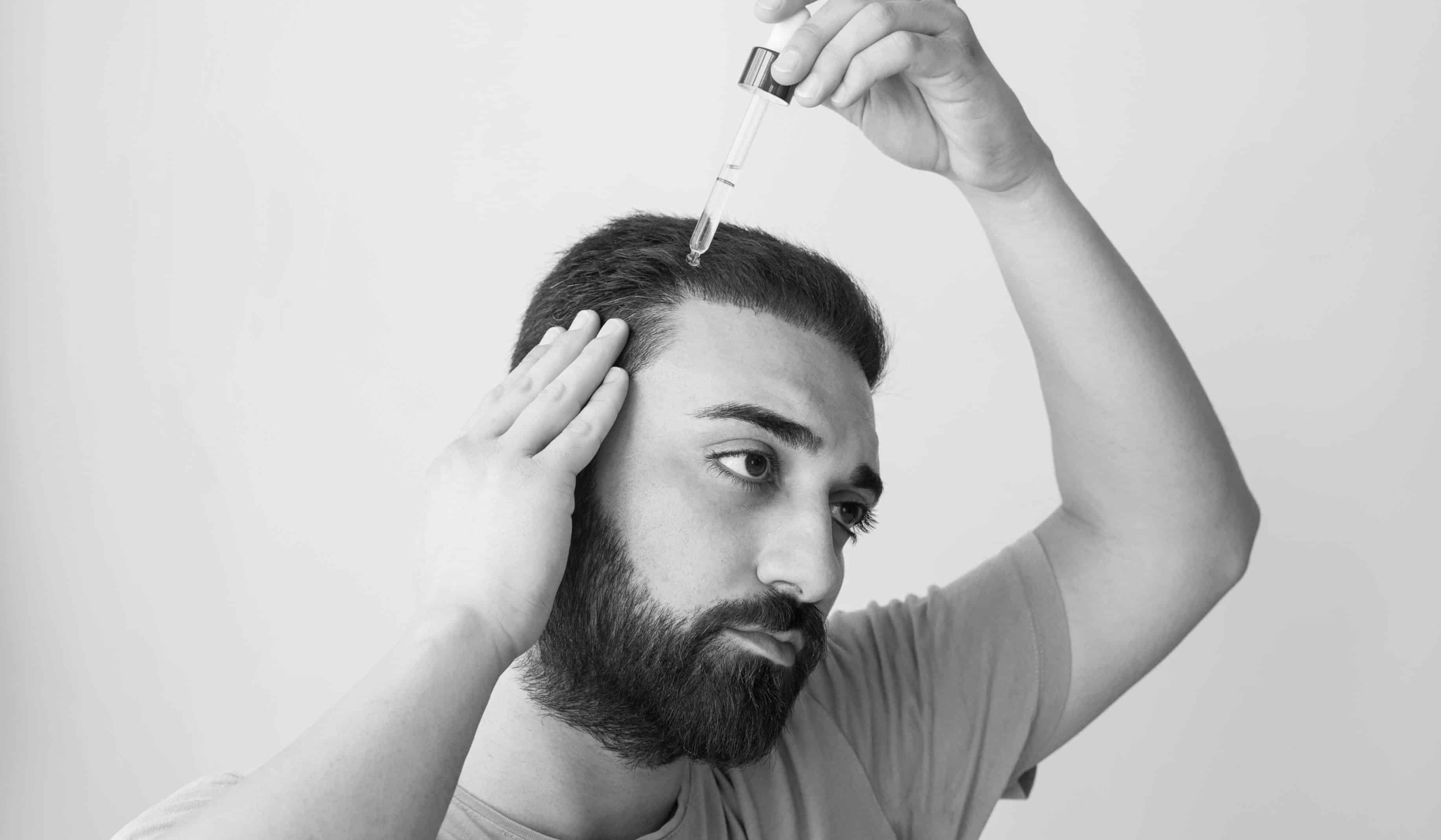 Quelles sont les précautions à prendre après une greffe de cheveux ? | CLEM | Suresnes
